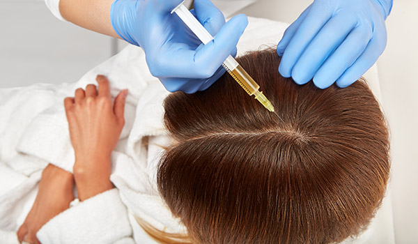 Hair Loss Treatment in Fujairah | Hair Loss Treatment in Dubai | CosmoMed